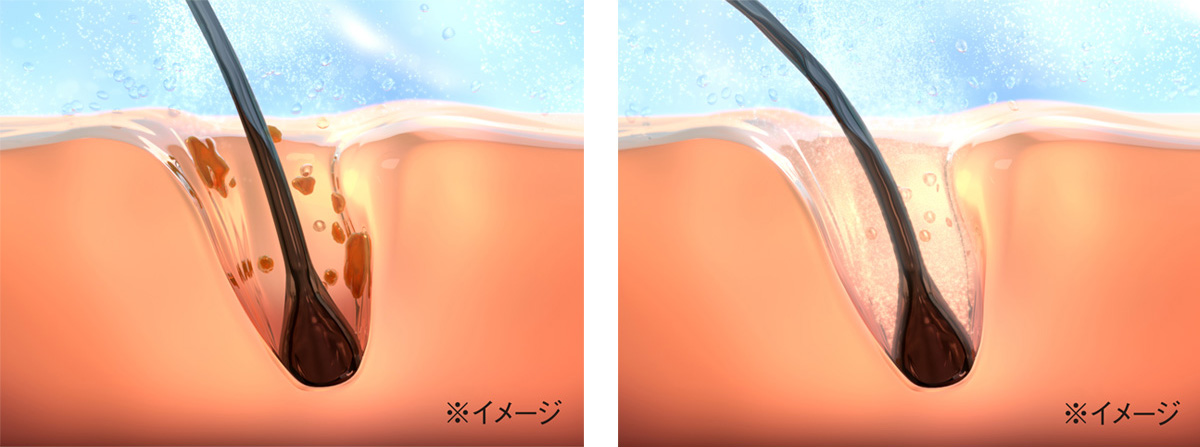リファファインバブル Sの画像